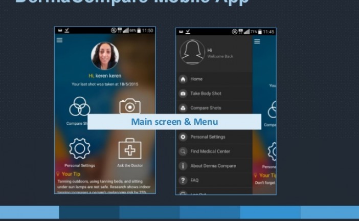 Analyser vos grains de beauté grâce à une application israélienne