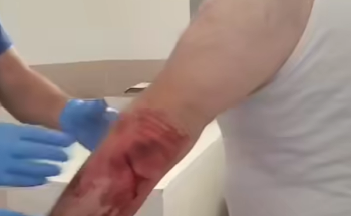 Video : URGENT — TENTATIVE DE MEURTRE DANS LA COMMUNAUTÉ JUIVE DE DJERBA