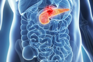 Cancer du pancréas : vers un espoir thérapeutique
