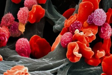 Des chercheurs anglais ont découvert un nouveau remède « révolutionnaire » contre le cancer aux résultats « sans précédent ».